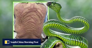 Китайка развива змиеподобни шарки по тялото си от използването на мехлем „чист TCM“ в продължение на 10 години